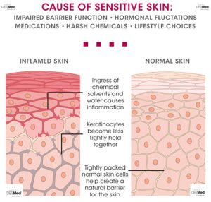 Understanding Rosacea and Sensitive Skin – Institut Dermed