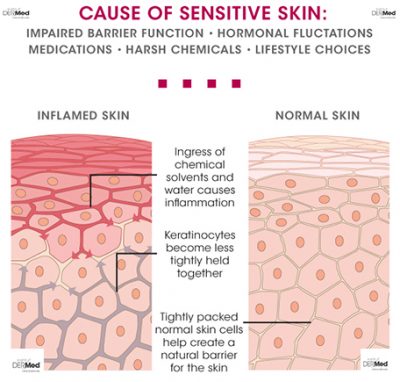 Understanding Rosacea And Sensitive Skin – Institut Dermed